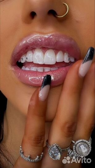Скайсы установка на зубы кристаллы swarowski