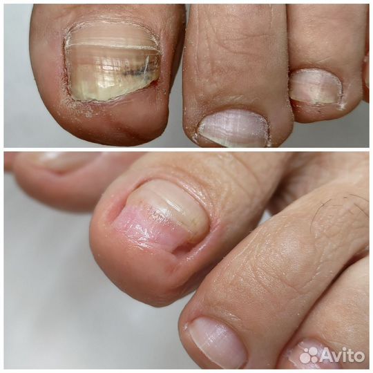 Педикюр и подология. Возможен выезд надом