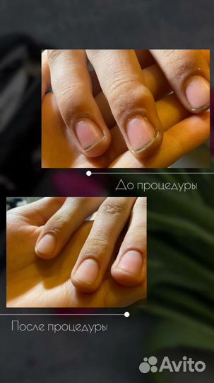 Маникюр на дому