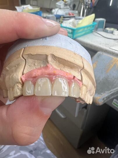 Зуботехническая лаборатория cad-cam центр