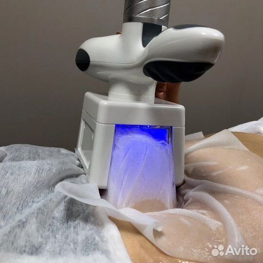 Криолиполиз