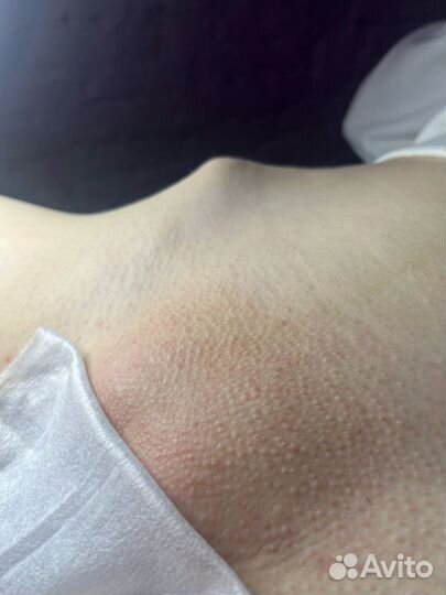 Шугаринг / Депиляция