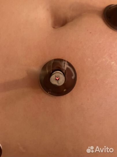 Моксатерапия