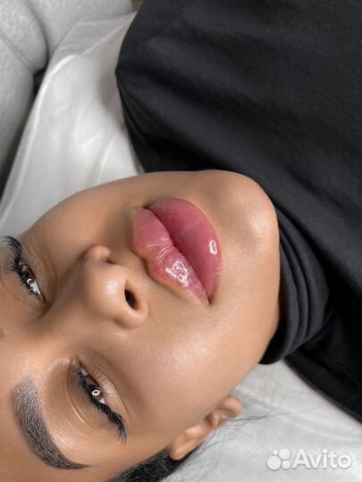 Увеличение губ
