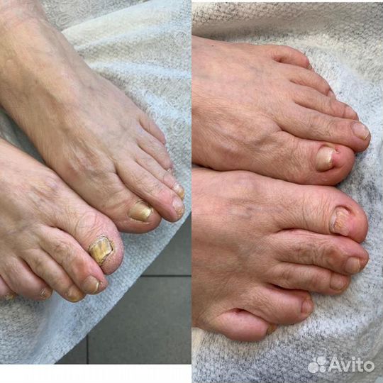 Педикюр С основами подологии