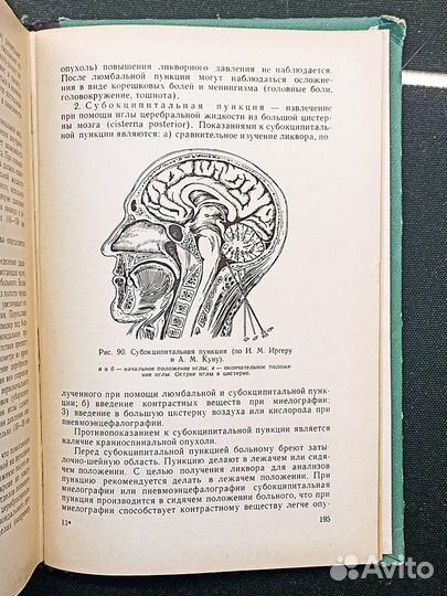 Практикум по невропатологии. Архангельский. 1967