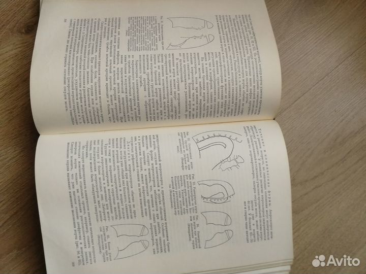 Внутренние болезни учебник Е.М.Тареева