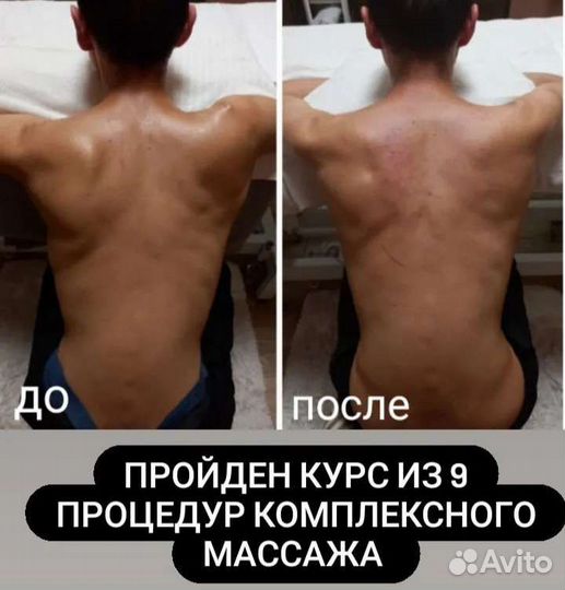 Лечебный массаж