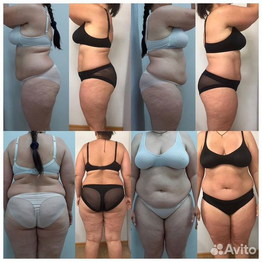 Аппаратное похудение, гарантированный результат