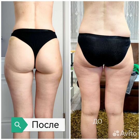 Ручной и аппаратный массаж