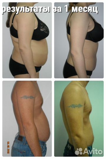 Коррекция фигуры и снижение веса.Похудение.Массаж