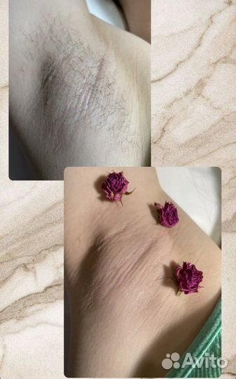 Мастер шугаринга