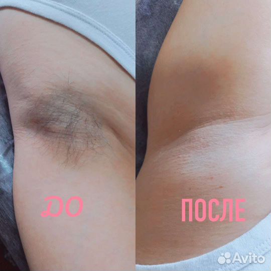 Модели на шугаринг