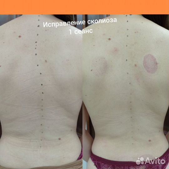 Массаж. Здоровье и красота вашего тела и лица