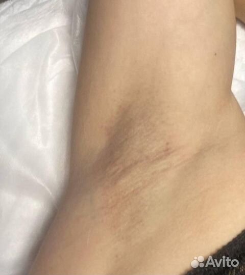 Депиляция сахар/воск