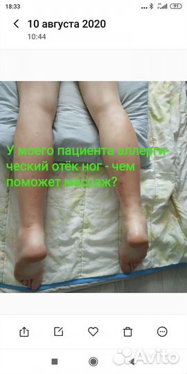 Профессиональный массаж