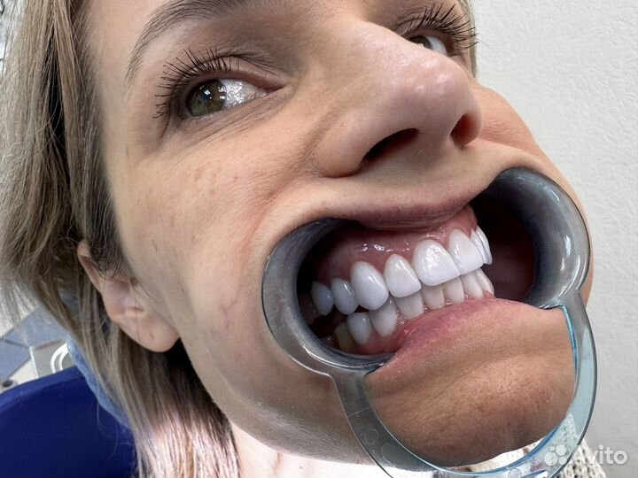 Стоматолог хирург имплантолог