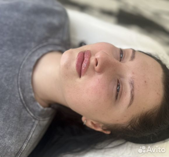 Увеличение губ / ботокс