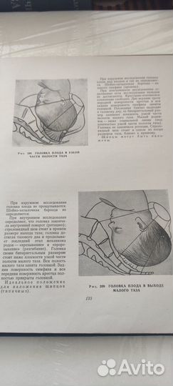 Оперативное акушерство. Атлас