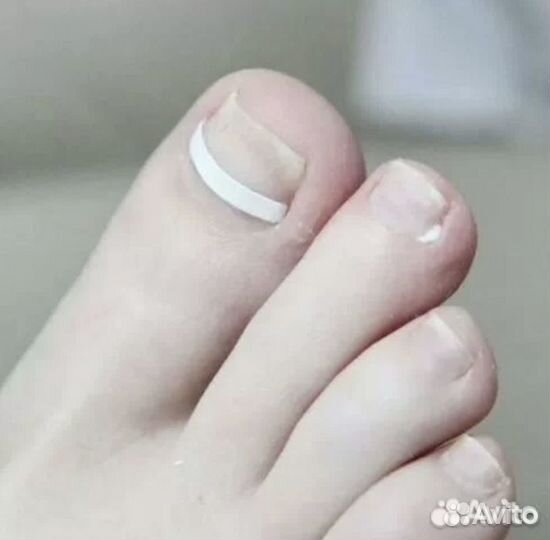 Подолог / Медицинский педикюр и маникюр