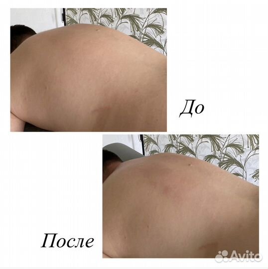 Массаж