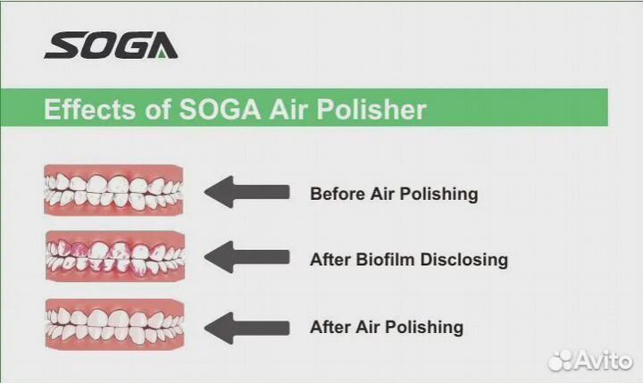 Soga Air Polisher эйрфло