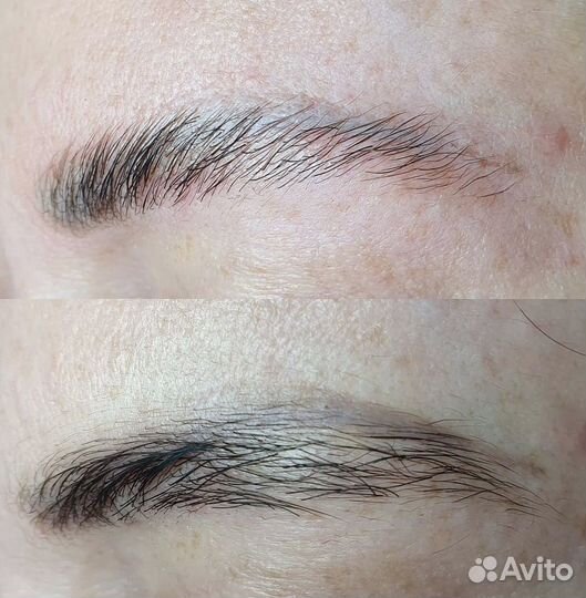 Удаление татуажа перманента мини - тату