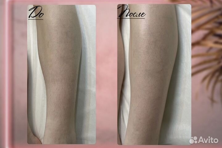 Восковая депиляция