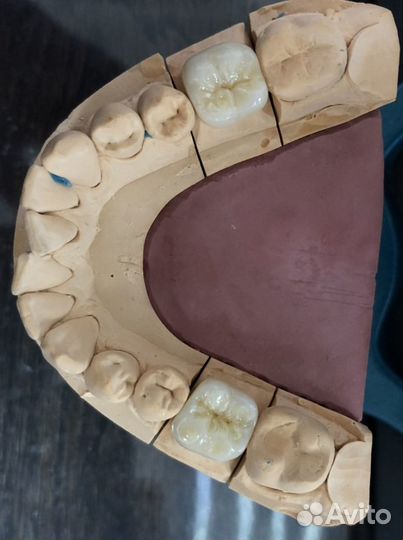 Зуботехническая лаборатория cad/cam. Зубной техник