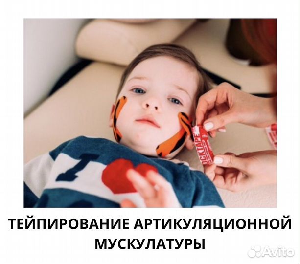 Тейпирование