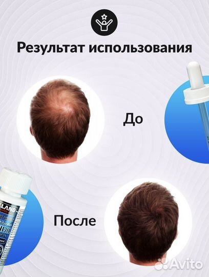 Миноксидил 5 для бороды