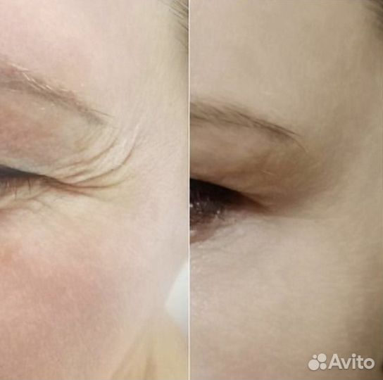 Full face (лицо под ключ) Ступино Московия