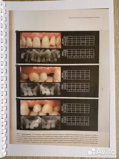 Диагностика и лечение заболеваний пародонта