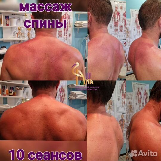 Массаж спины и шейно-воротниковой зоны
