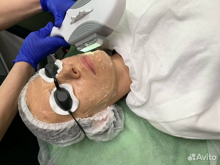 Фотоомоложение