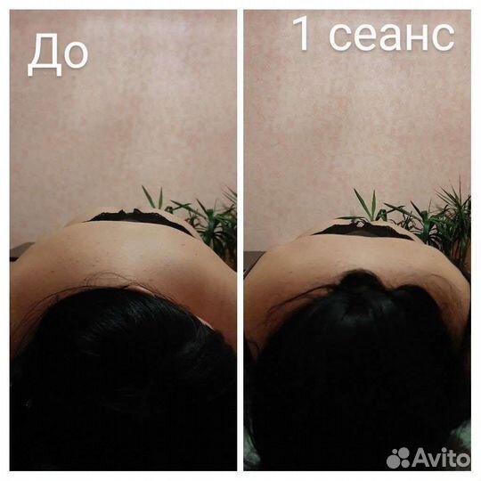 Миофасциальный массаж