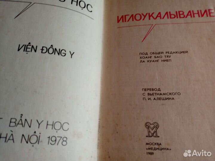 Иглоукалывание