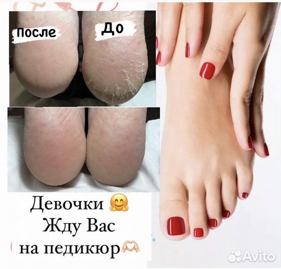 Наращивание ногтей