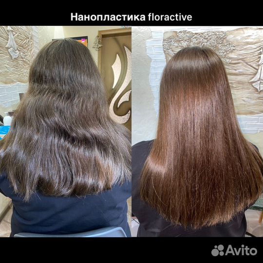 Нанопластика floractive, ботокс, биксипластия