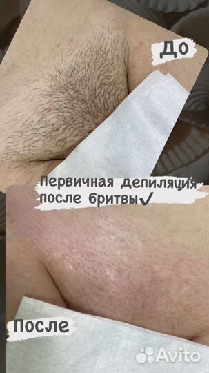 Депиляция, шугаринг, воск