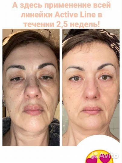 Набор уходовой косметики для лица новый