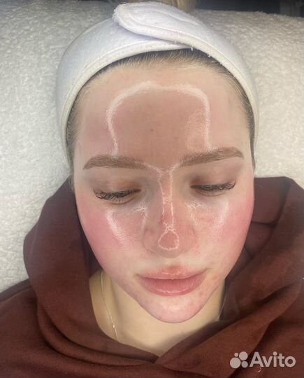 Milk Peel молочный пилинг