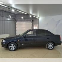 Hyundai Accent 1.5 MT, 2009, 148 533 км, с пробегом, цена 709 900 руб.