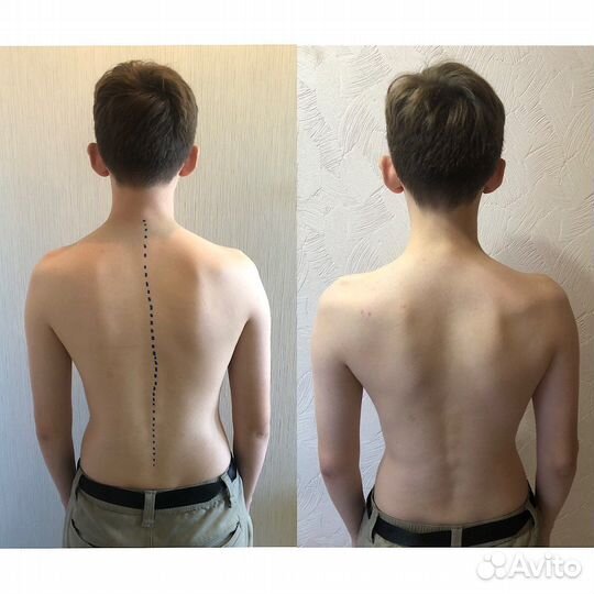 Массаж, кинезиолог-массажист