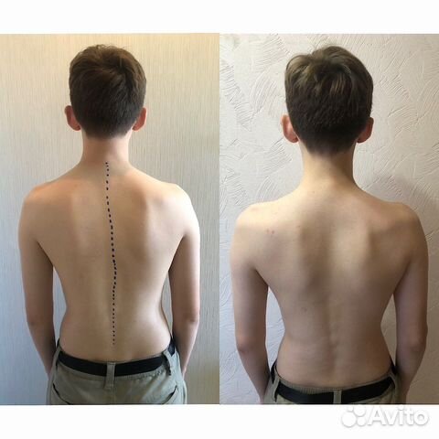 Массаж, кинезиолог-массажист