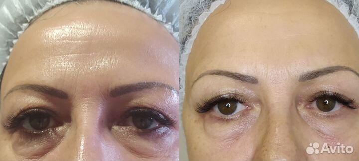 Моделирующий массаж лица и шеи для женщин