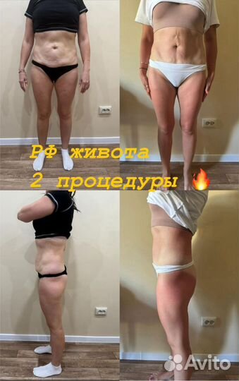 Коррекция фигуры