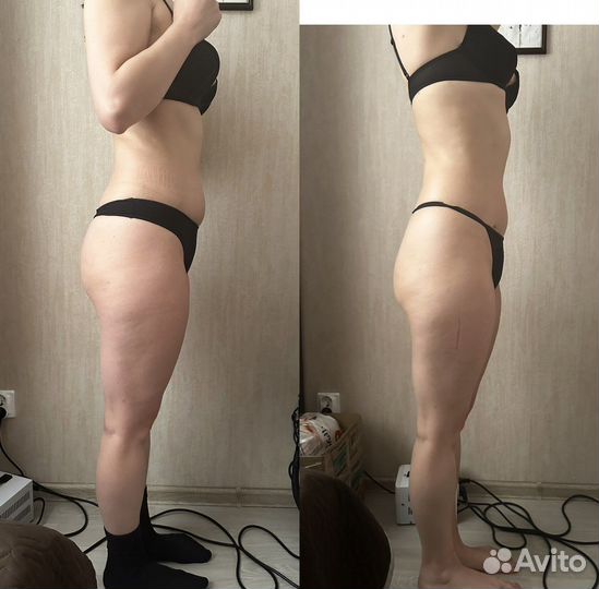 Услуга «лежи И худей»