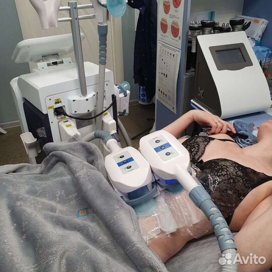 Криолиполиз
