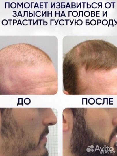 Миноксидил оригинал